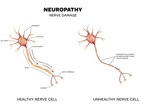 Sciatica  Back and Neck Clinic Sapulpa